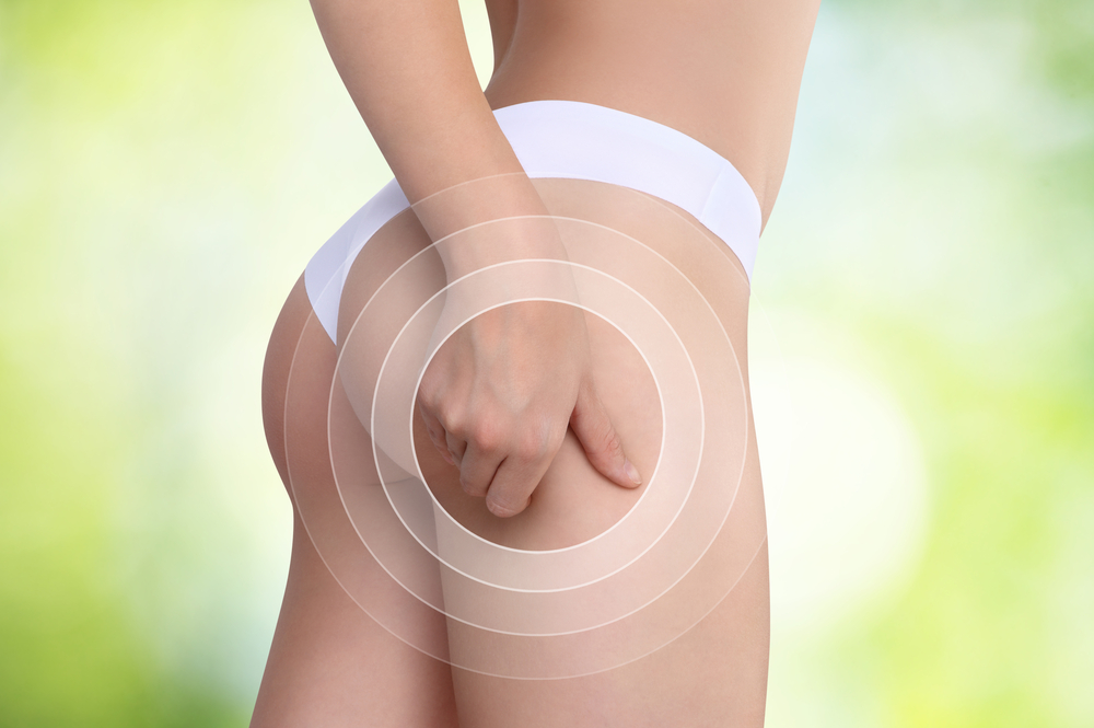 Why Cellulite is Considered as the Best Treatment for Removing